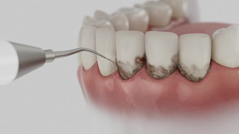Trusted Teeth Cleaning And Checkup service in Howard, WI - Dentist Open Now
